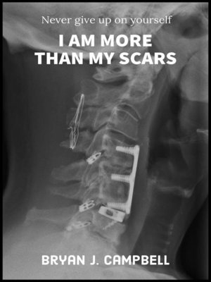 cover image of I Am More Than My Scars — Never Give Up On Yourself